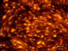 �I�����W�َq�ƍזE